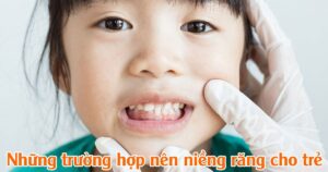 1 ZAVATESLA Chăm Sóc Răng Trẻ Em Đúng Cách - Khởi Đầu Cho Nụ Cười Khỏe Mạnh Suốt Đời nụ cười khoẻ mạnh