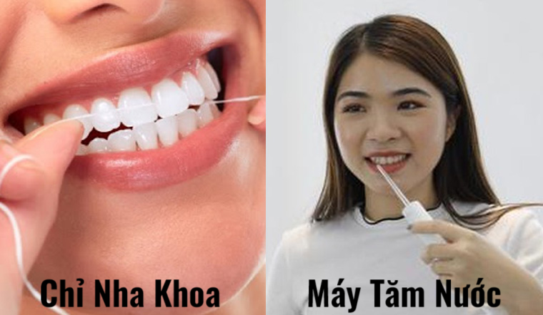 nen su dung chi nha khoa hay tam nuoc 202008181044286751 ZAVATESLA Hướng Dẫn Chăm Sóc Răng Sau Khi Niềng - Giữ Kết Quả Bền Vững, Ngăn Ngừa Tái Lệch chăm sóc răng chăm sóc răng