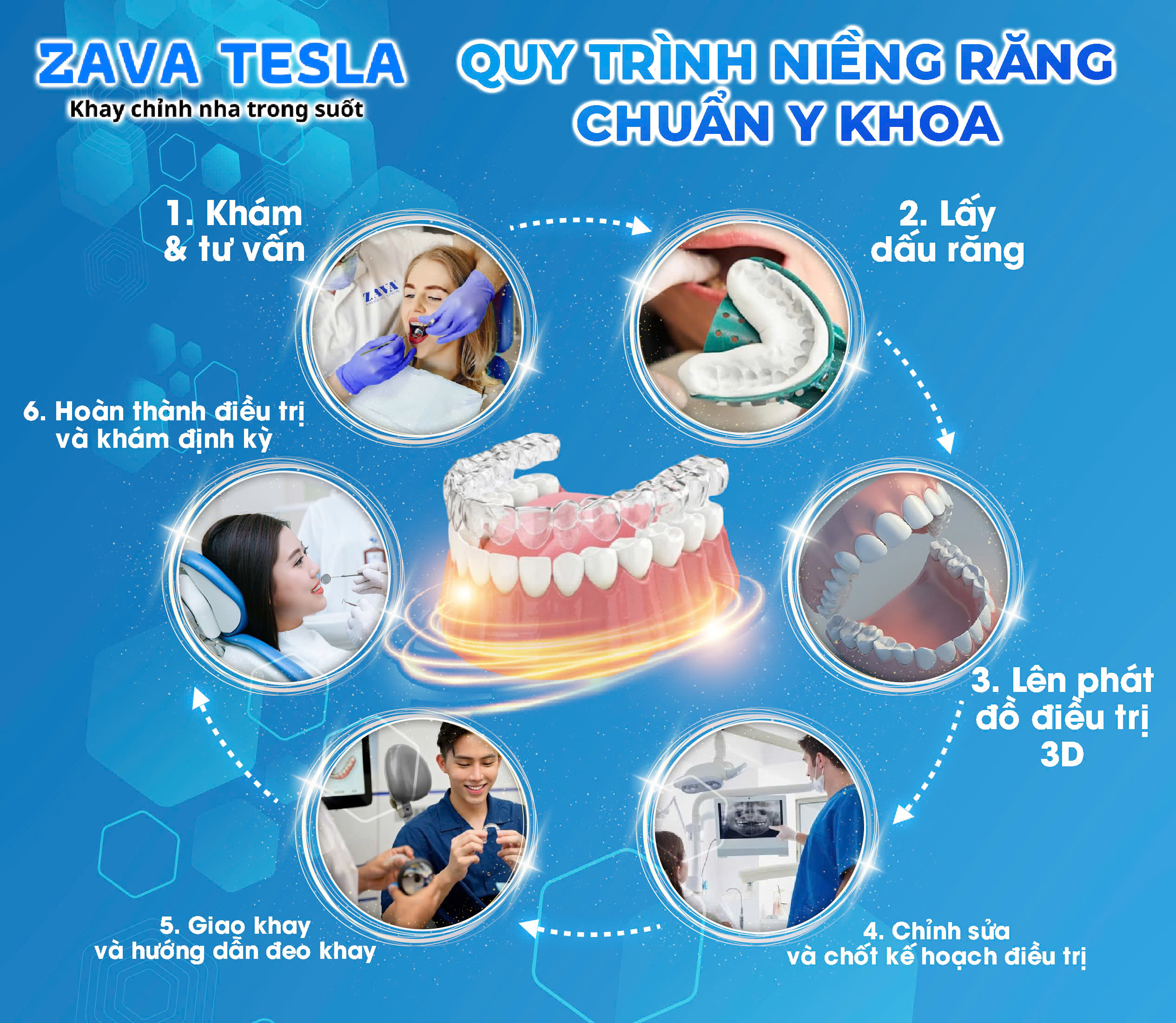 z6453926272030 338c5c874e1305a6fc2c9953d3be1ffd ZAVATESLA Niềng Răng Trong Suốt – Giải Pháp Thẩm Mỹ, Hiệu Quả, Không Đau niềng răng trong suốt niềng răng trong suốt,niềng răng trong suốt giá bao nhiêu