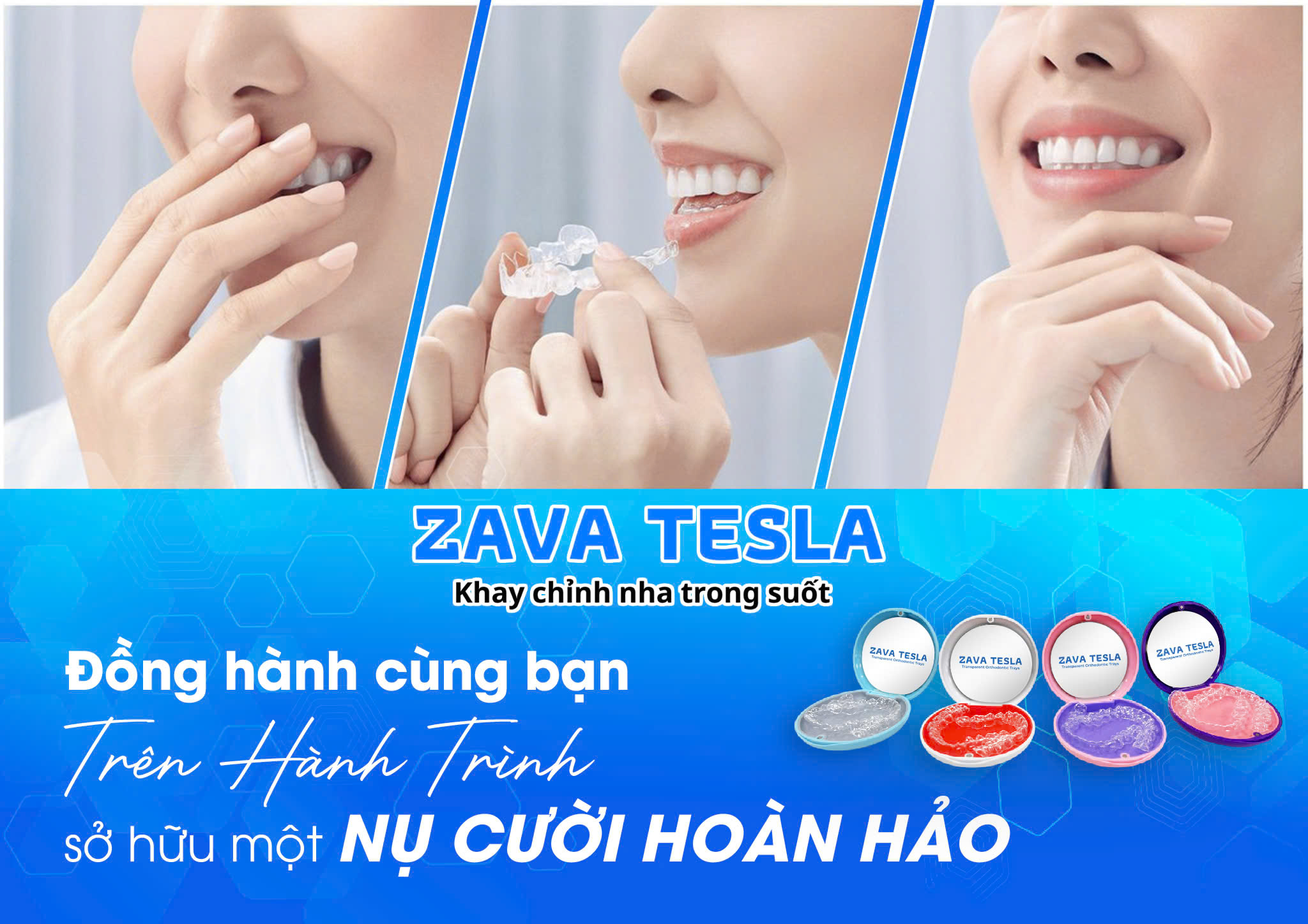 z6521129367575 a6a870cad946ede63bd0ecf82e313e47 ZAVATESLA Niềng Răng Là Gì? Những Kiến Thức Cần Biết Trước Khi Niềng Răng niềng răng niềng răng